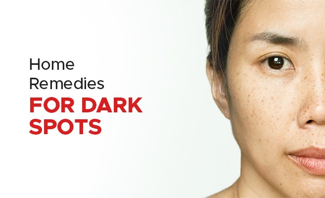 How to fade dark spots fast